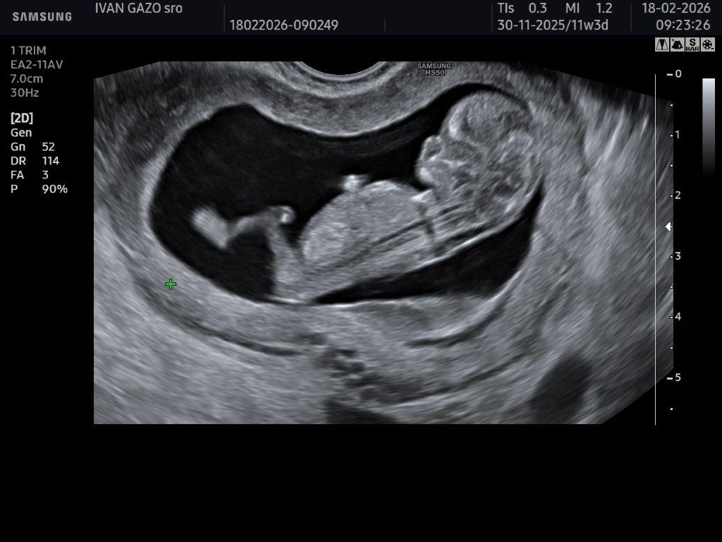 Starostlivosť o tehotné